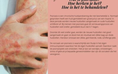 Wat is psoriasis? Hoe herken je het? Hoe te behandelen?